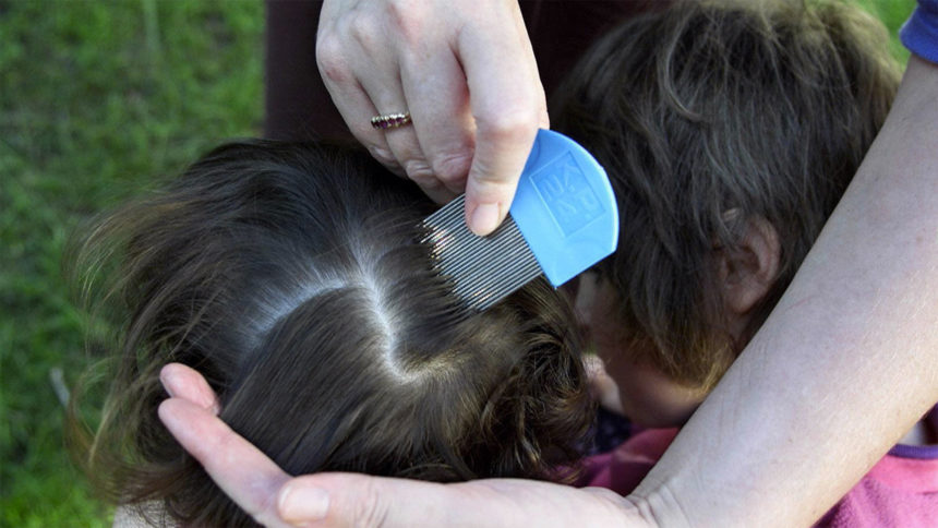 Lice Tip: Act Quickly